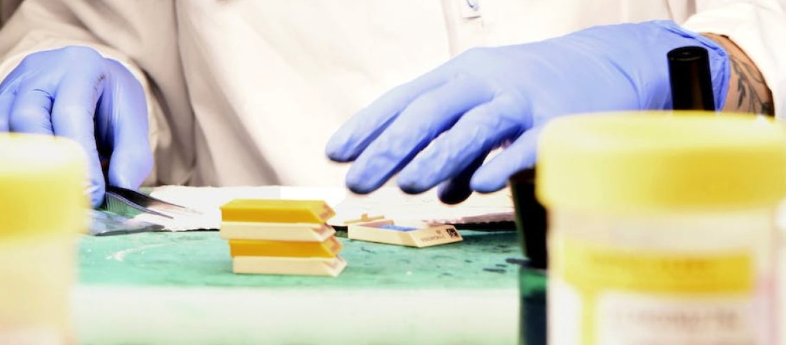 Qu'est-ce qu'un examen histologique exactement ?